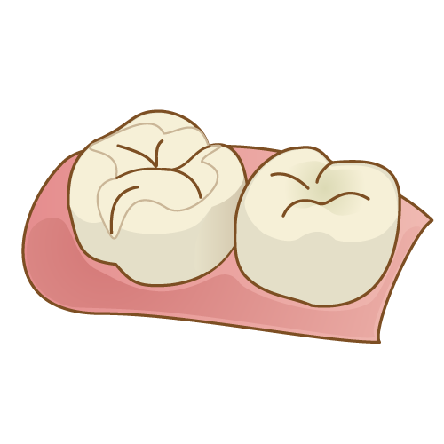 セラミックの写真